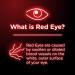Visine Red Eye Hydrating Comfort - Lubricant & Redness Reliever Eye Drops 12 fl oz - Buy Online on GoSupps.com