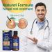 Extra Strength Toe Nail Fungal Treatment - Hongos Fungal Remover Liquid with Brush | Repair Damaged Nails (30ml/1fl oz Pack of 2 - Buy Online on GoSupps.com