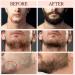Beard Butter for Men - Natural Mustache Balm & Hair Growth Formula | Vesone 0.68 oz - Buy Online on GoSupps.com