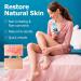 Roycederm Herpes Relief Cream - 60g | Gentle Treatment for Sensitive Skin - Buy Online on GoSupps.com