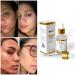 CCHANS 4in1 Vitamin C SERUM Anti-Aging Moisturizing Retinol Organic lightening serum Hyaluronic Acid & Niacinamide Dark spots serum Pura Serum Fine Lines & Wrinkles Korean Serum1 Fl Oz 30ML. - Buy Online on GoSupps.com