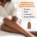 Palmer's Cocoa Butter Scar Serum 1 oz - Effective Scar Treatment & Skin Repair - Buy Online on GoSupps.com