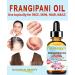Botanical Beauty Frangipani Oil 100% Natural 2 Fl. oz - 60 ml Frangipani Essential Oil for FACE Skin Body Hair Nails Beauty Oil Skin Moisturizer Oil Nourishing Oil Perfume Soap Making - Buy Online on GoSupps.com