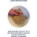 Metatarsal Pads - Gel Cushion Sleeves for Foot Pain Relief - Medium Beige (Women 5.5-9.5, Men 4-7.5) - Buy Online on GoSupps.com