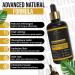 Fungal Nail Treatment for Toenails Extra Strong Fast-Acting Nail Fungus Treatment for Toenail with Natural Tea Tree Oil Visible Results in 1-3 Weeks 30 ML Toe Nail Fungal Healthy for Treatment - Buy Online on GoSupps.com