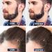 Beard Roller 0.5mm - Derma Roller for Beard Growth & Skin Care | Micro Needle Roller for Men & Women - Buy Online on GoSupps.com