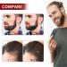 Iopykkoa Beard Roller 0.5mm Microneedling Derma Roller for Beard Growth & Care | International Shipping - Buy Online on GoSupps.com