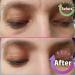 Adofect Sakura Extract Gel Eye Mask - 30 Pairs for Puffy Eyes, Wrinkles & Dark Circles - Buy Online on GoSupps.com