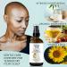 Epifany True Scalp Soothing Oil 4oz - 100% Natural & Vitamin E Rich for Itchy Dry Scalp | Intensely Moisturizing & Calming to Sunburns - Buy Online on GoSupps.com