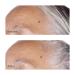 Perricone MD Vitamin C Ester Brightening Peel 2 fl. oz - Buy Online on GoSupps.com