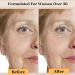 Premium 20% Vitamin C Facial Serum with Hyaluronic Acid | Anti-Aging Solution for Dark Spots & Fine Lines | 1 fl oz - Buy Online on GoSupps.com