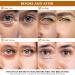Snake Venom Eye Cream - Anti Wrinkle Eye Cream For Puffiness + Wrinkles Brightening Under Eye Cream Diminishing Deep Wrinkles Dark Circle Eye Cream Eye Bag Treatment For Men And Women 30g - Buy Online on GoSupps.com