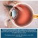 BASE LABORATORIES Corneal Edema Eye Ointment | 3% Sodium Chloride Ophthalmic | Hypertonicity Eye Drops - Triple Pack 15g - Buy Online on GoSupps.com