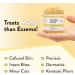 Eczema Honey Original Skin-Soothing Cream for Sensitive Skin | Fast Relief for Dry, Itchy, Irritated Skin | With Colloidal Oatmeal and Restorative Oils | 4oz Cruelty Free Formula - Buy Online on GoSupps.com
