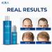 ALIKA Combo Shampoo & Serum Set for Men's Hair Growth | Boost Hair Loss Treatment | Suitable for All Scalp Types - Buy Online on GoSupps.com