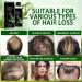 New 2026 Organic Rosemary Hair Growth Shampoo Rosemary Hydrolyzed Keratin Shampoo Volumizing For Thinning Hair & Hair Loss Nourishes & Repairs Hair Strands Unisex Formula 1Pcs - Buy Online on GoSupps.com