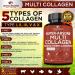 Wholesome Super-Absorb Multi Collagen Pills - 90 Capsules for Skin  Joint & Hair Health - Buy Online on GoSupps.com