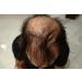 Hair Building Fibers Soft Black - 25g Refill | Finally Hair - Premium Quality for Thicker Hair - Buy Online on GoSupps.com