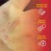 Scar Zone Burn Pain Relief Gel - Extra Strength Topical Analgesic for Minor Cuts, Burns & Abrasions (0.5 oz) - Buy Online on GoSupps.com