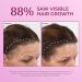 BosleyMD Extra Strength 2%-5% Thinning Hair Treatment Foam 2oz for Men and Women - Hair Loss & Regrowth Solution - Buy Online on GoSupps.com