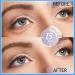 Hydrating Under Eye Patches (28 Pairs) - Anti-Aging Masks for Dark Circles Puffiness & Wrinkles | Best Eye Care for Women - Buy Online on GoSupps.com