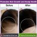 Organic Rosemary Oil for Hair Growth - 100% Pure Essential Oil with Hair Roller | Non-Greasy Hair Growth Serum for Women & Men - Eyebrow, Eyelash and Scalp Care - Buy Online on GoSupps.com