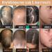 Biotin Hair Growth Conditioner for Men & Women | Vegan DHT Blockers Caffeine Saw Palmetto | Thinning Hair Treatment Cruelty & Paraben Free - Buy Online on GoSupps.com