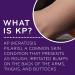 AmLactin KP Bumps Be Gone Hydrating Cream - 3 Oz Tube - Buy Online on GoSupps.com