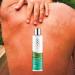 Curaloe Aloe Vera Body Gel | 95% Pure Organic Aloe with Lavender & Tea Tree Oil | Soothes Dry Skin, Cools Sunburn | Moisturizes & Softens | Unscented | Men & Women - Buy Online on GoSupps.com