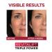 L'Oreal Paris Revitalift Triple Power Anti-Aging Face Moisturizer | Pro Retinol, Hyaluronic Acid, Vitamin C | Reduce Wrinkles, Firm & Brighten Skin | 2.55 oz - Buy Online on GoSupps.com
