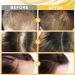 Beayosses Dermaroller Set 0.5mm - Microneedling Skin Roller & Hair Growth Serum (30ml) | Anti-Hair Loss Treatment | Promote Hair Growth - Buy Online on GoSupps.com