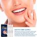 Teeth Whitening Pen 4 Pack, Brighten Your Smile in Just 1 Week with Tooth Whitening Pens  Fast, Gentle, Enamel Safe 35% Carbamide Peroxide Whitening Gel for White Teeth in Mess Free Applicator Pens - Buy Online on GoSupps.com