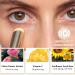 Vitamin C Eye Cream Stick Dark Circle Eye Cream Anti Aging - Eye Cream For Wrinkles Eye Bags Remover Women Under Eye Cream - Reducing Fine Lines Smoothens Wrinkles Eye Balm For Puffiness - Buy Online on GoSupps.com