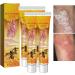 EXQST New Zealand Bee Venom Psoriasis Soothing Moisturizing Cream