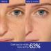 Caudalie Vinoperfect Brightening Dark Spot Serum Vitamin C Alternative - 62x More Effective than Vitamin C with Viniferine for a Visibly Brighter Even Complexion 30 mL (Pack of 1) - Buy Online on GoSupps.com