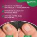 100ml All-Natural Anti Fungal Toenail Spray for Severe Toenail Fungus Treatment - Buy Online on GoSupps.com
