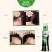 Buy New Improved Herbal Hair Oil with Wonder Cap (100 ml) - Enhance Hair Growth & Shine | International Shipping Available - Buy Online on GoSupps.com