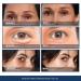 Bag Buster Eye Cream - Instant Reduction & Anti-Aging | Rapid Lift for Wrinkles Dark Circles & Fine Lines | Powdery Residue Free | 10ml - Buy Online on GoSupps.com