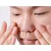 MIZON Nose Patch for Blackheads & Acne | Goodbye Blemish Line | 10 Count Pore Cleansing Strips - Buy Online on GoSupps.com
