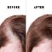 Bald Spot Hair Growth Cream | Scalp Treatment for Receding Hair | Just Nutritive | 4 Oz | Unisex Hair Restoration - Buy Online on GoSupps.com