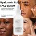 Hyaluronic Acid Brightening Serum 30ml - Dark Spot Remover & Discoloration Corrector for Face - Anti Aging Moisturizer - Buy Online on GoSupps.com