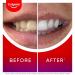 Colgate Max White Overnight Teeth Whitening Serum home teeth whitening pen reverses 15 years of stains new and improved applicator - 0.084 Oz - Buy Online on GoSupps.com