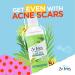 St.Ives Solutions 3-in-1 Face Toner - Tea Tree Extract & Witch Hazel - 8.5 oz - Buy Online on GoSupps.com