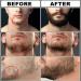 Beard Growth Kit 4 in 1 Men's Grooming Set with Roller, Serum, Balm | Birthday Gifts for Dad, Boyfriend - Buy Online on GoSupps.com
