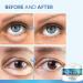 Buy Glycolic Acid Eye Cream 30g - Anti Wrinkle Hydrating Reduces Dark Circles & Puffiness - Buy Online on GoSupps.com