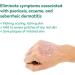 Dr. Blaine's REVITADERM Psoriasis Formula - Coal Tar Tea Tree Oil Lavender Cream for Dry Skin Relief - 4 fl. oz - Buy Online on GoSupps.com