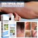 DUBUSH Psoriasis & Eczema Soothing Mist Set - Herbal Treatment for Skin Rejuvenation | All Skin Types - 3pcs - Buy Online on GoSupps.com