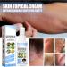 Melllop Brume de soulagement du psoriasis base de plantes brume de soulagement du psoriasis base de plantes hydrate la peau d licate de peau 1 Pi ce. - Buy Online on GoSupps.com