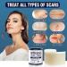 Silicone Scar Tape (1.6 x 120) - Reusable Medical Silicone Sheets for Tummy Tuck, C-Section, Surgery, Burn, Keloid, Acne - Highly Comfortable - Buy Online on GoSupps.com