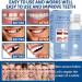 Temporary Tooth Filling Repair Kit - Moldable False Teeth Replacement | Tooth Repair Granules for Quick Fix | Fake Teeth Repair Beads - Buy Online on GoSupps.com